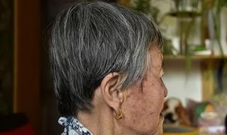 怎样去除脸上老年斑 去老年斑的有效方法